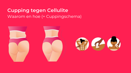 Cupping tegen Cellulite