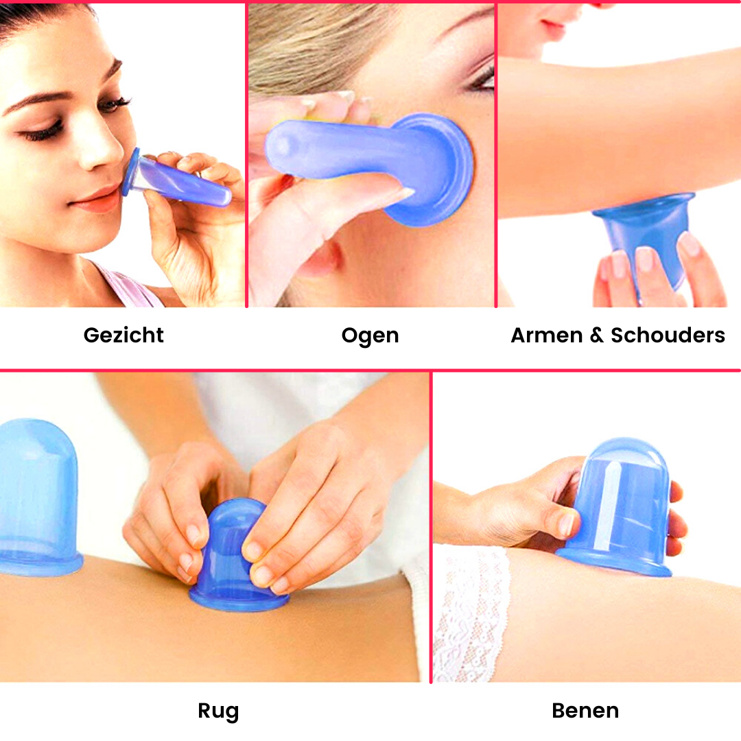 Toepassing van cellulite cups